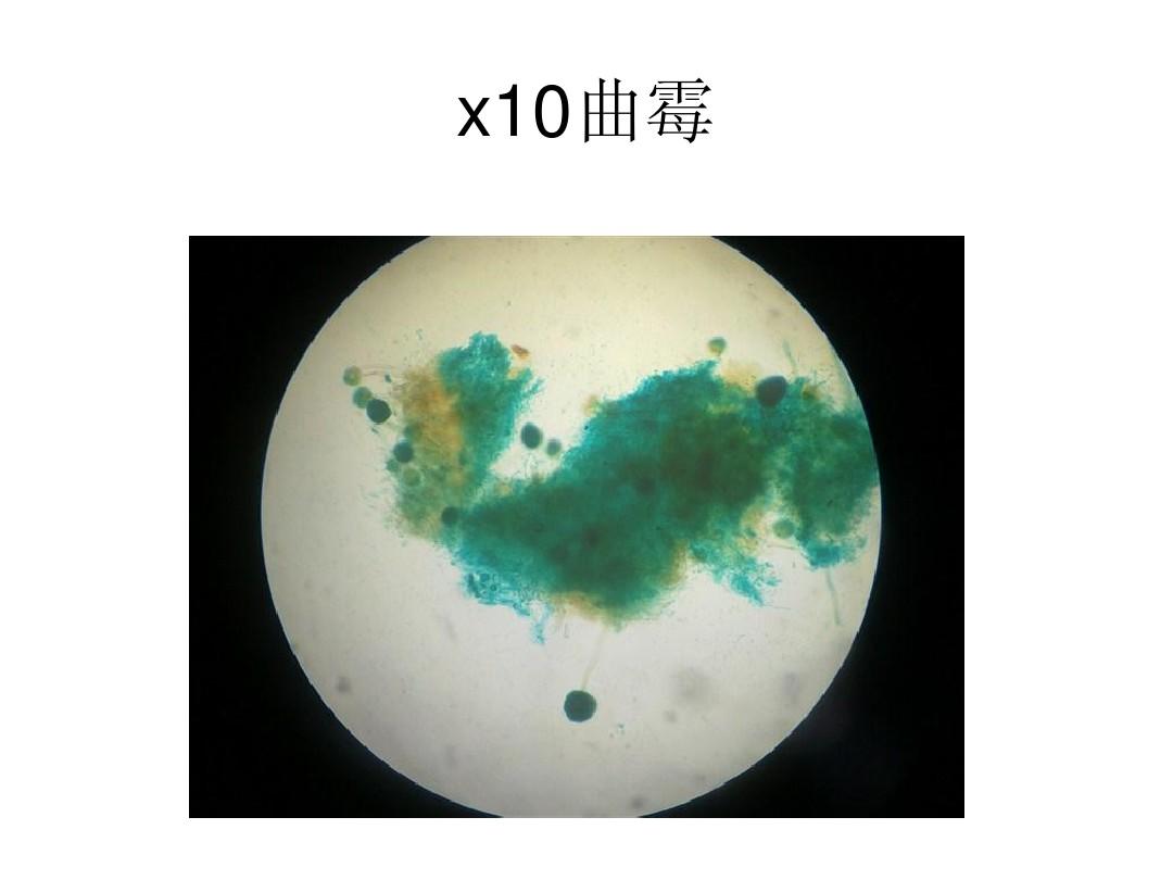 显微镜下霉菌(黑曲霉、根霉、青霉)形态观察图